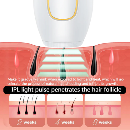 A1 Laser Hair Remover