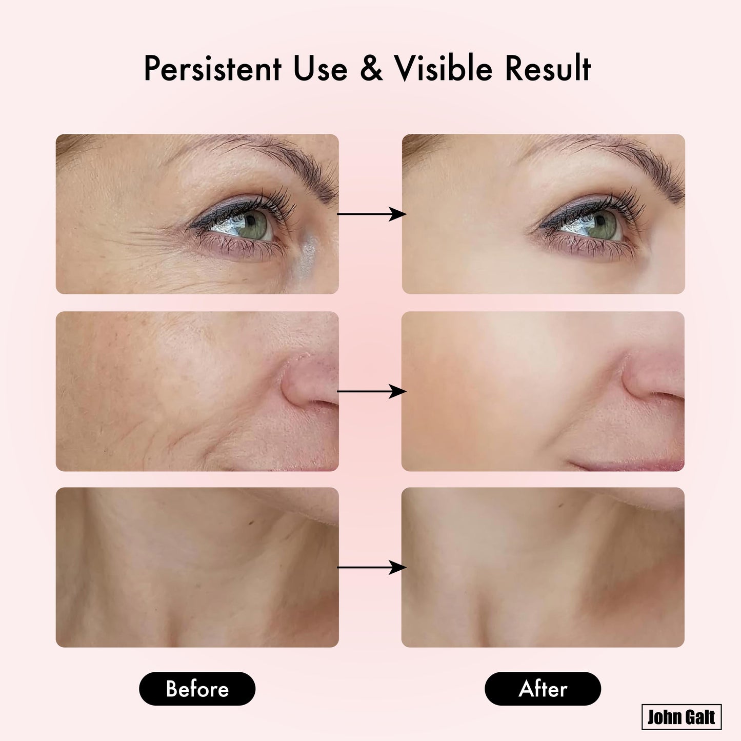 Red Light Therapy Massager for Face and Neck, 7 Color Led W/ Skin Care