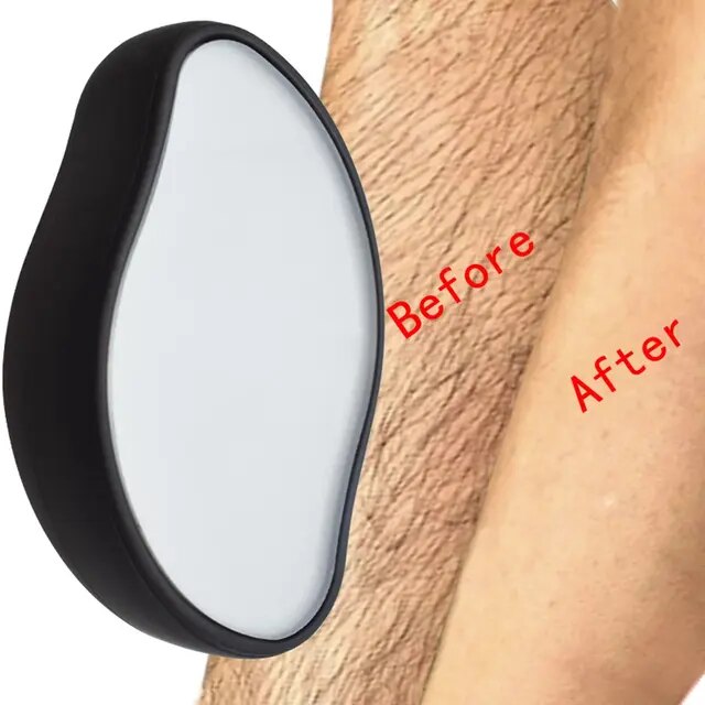 A1 Laser Hair Remover